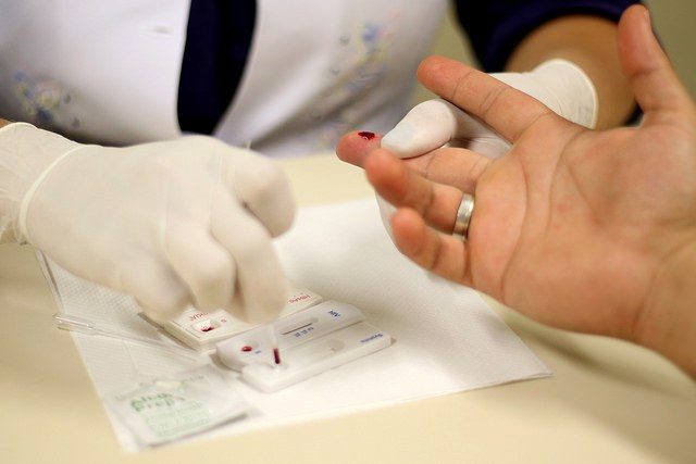 Testes Rápidos Detectam HIV, Sífilis E Hepatites B E C | Içara News