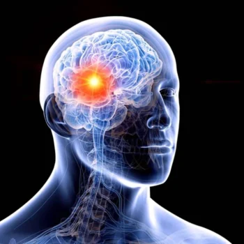 Maio Cinza: Unidade do Estado, Cepon alerta para sinais do câncer cerebral