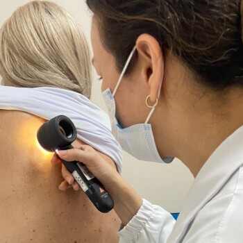 Estado reforça a importância da prevenção e do diagnóstico precoce do melanoma