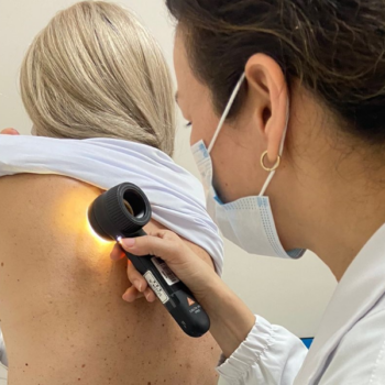 Melanoma preocupa em Santa Catarina: Estado deve registrar 1,2 mil novos casos até o fim de 2026